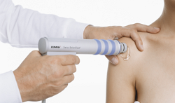 ESWT Shockwave Therapy